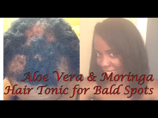 Aloe Vera with Moringa Hair Tonic Tutorial for Bald Spots