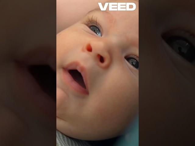 Explained quickly in 30 Seconds! The Surprising Science Behind Yawning and why So Contagious?