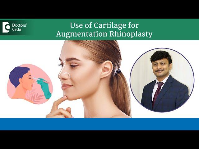 Increase Nose Height with Cartilage | Augmentation Rhinoplasty-Dr.Prashantha Kesari| Doctors' Circle