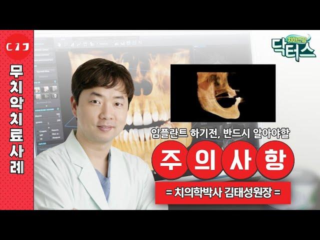 임플란트 하기 전, 반드시 알아야 할 주의사항!