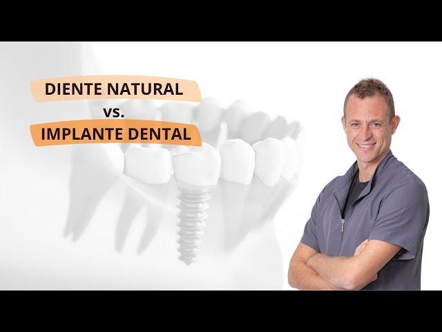 ¿Por qué es mejor conservar mi diente natural? Diente natural vs. Implante dental - Javier Ochagavia