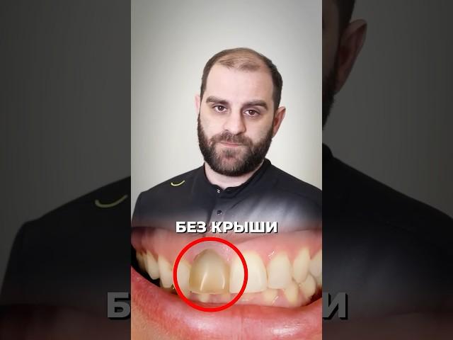 Почему коронка — это инвестиция в здоровье зубов? #стоматология