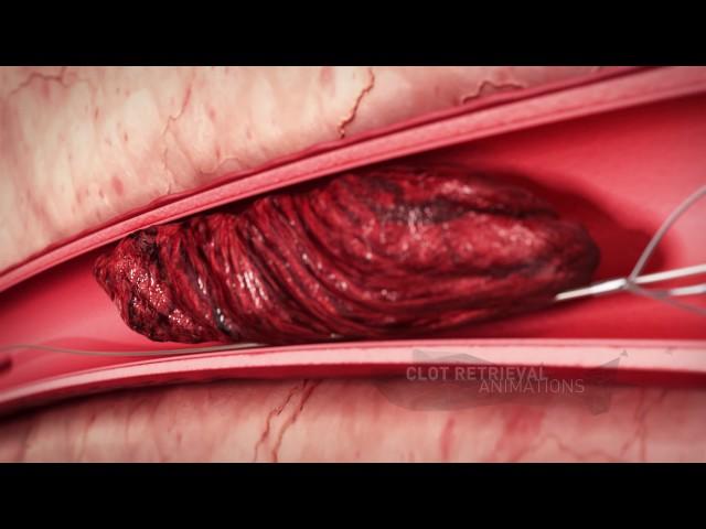 MVR Medical Animation showreel mvr co il