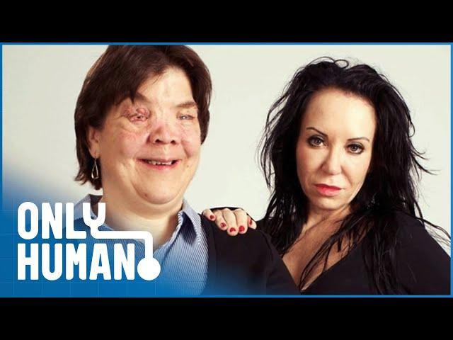 A Beauty Addict Meets A Woman With Facial Disfigurements | Only Human