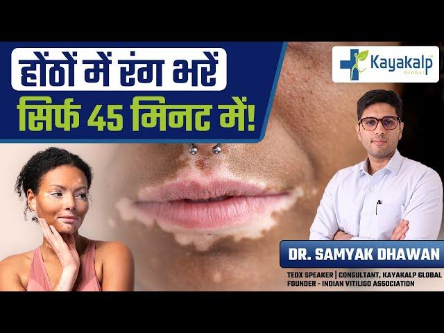 Lip Vitiligo Treatment | Permanent Color with Micropigmentation | Kayakalp Global
