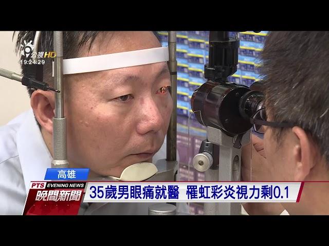 35歲男眼痛就醫　罹虹彩炎視力剩0 1 20170910 公視晚間新聞