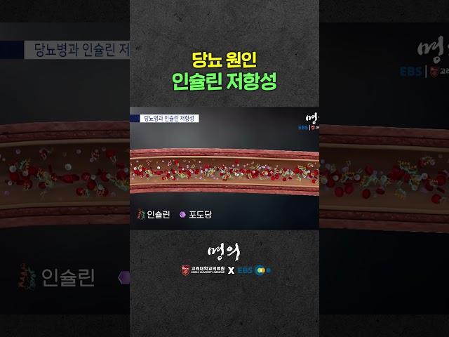 인슐린 저항성 한번에 이해하기️