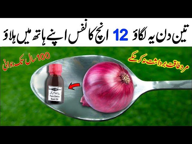 Onion Oil Mix Onion Recipe by Mrdesi | Healthiest Lunch Recipe | Yummy and Tasty Recipe