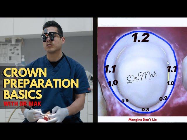 Crown Preparation Basics by DR Mak