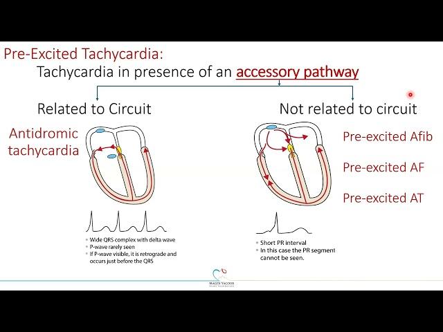 5. Wide complex Tachyarrhythmia Dr gendy