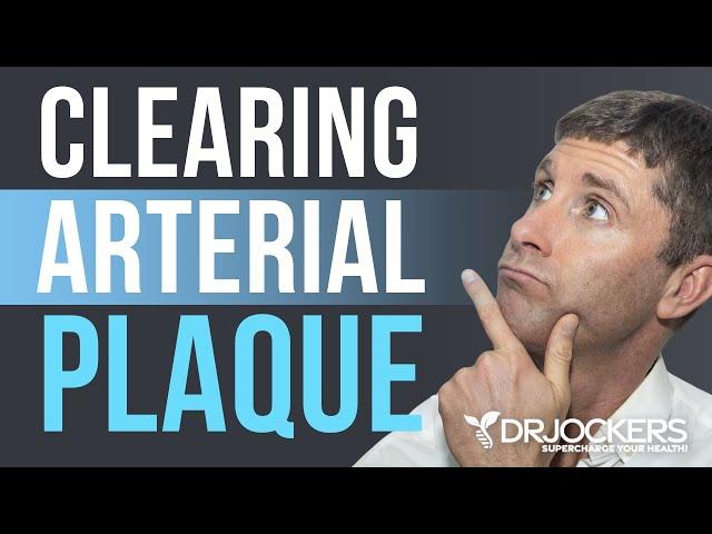 Clearing Arterial Plaque - Dr David Jockers