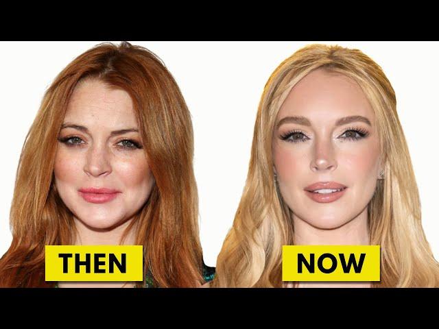 Lindsay Lohan’s Stunningly Youthful New Look: the Plastic Surgeries That Make Her Look Younger