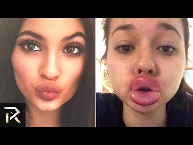 10 People Who Failed Viral Internet CHALLENGES