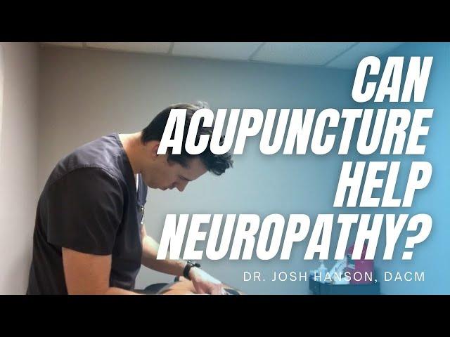 Can Acupuncture Help Neuropathy?