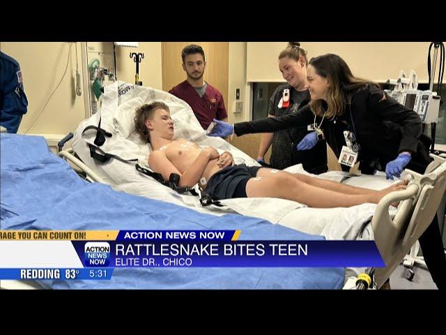 Chico teen recovering after being bitten by a rattlesnake over the weekend