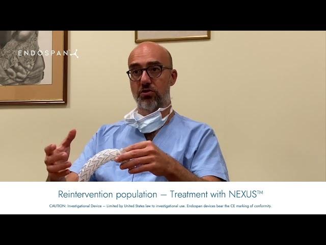 Reintervention population and treatment with NEXUS® - Augusto D'Onofrio, MD