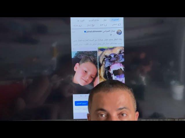 وفاة الطفل محمد جرادات رحمة الله عليه السبب مع جمال العمواسي