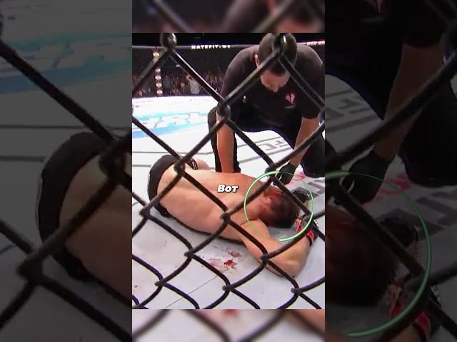 Пальцы в перчатке #ufc #mma
