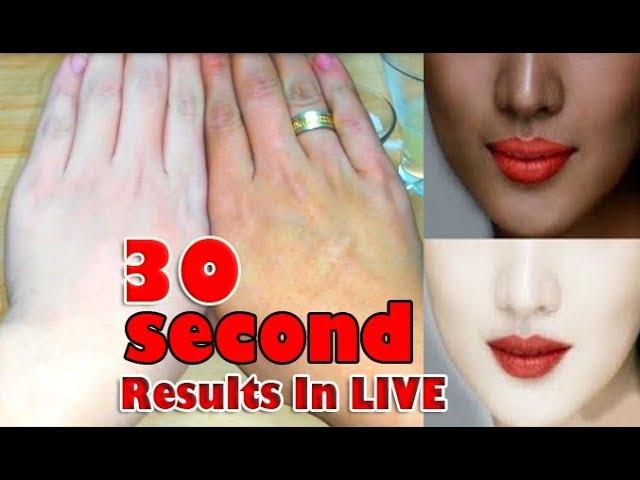 Skin Lightening Overnight | how to brighten skin Miracle Formula (Results In LIVE) everyday culture