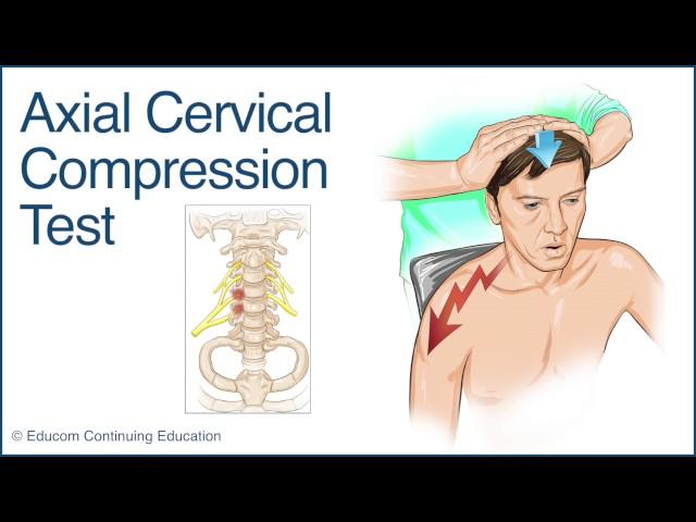 Axial Cervical Compression Test - A Chiropractic Online CE™ Production