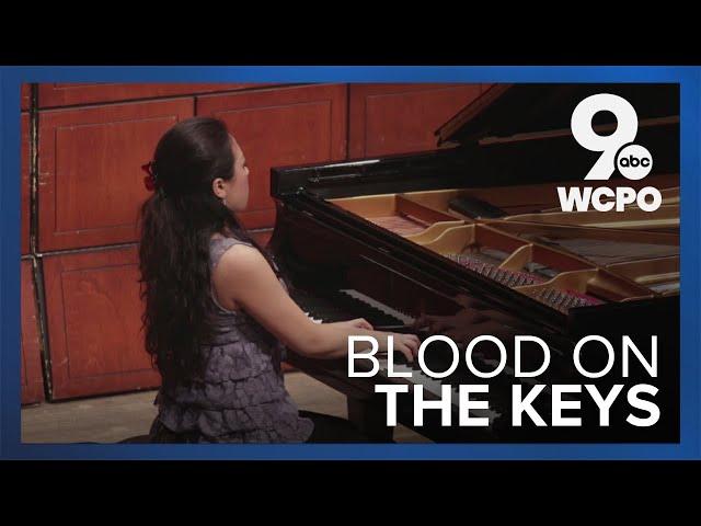 Bloody piano keys: Pianist says 'it doesn't hurt, actually'