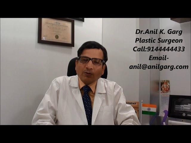 Truth About Minoxidil Side Effects 2%, 5%, 10% | Side effects of Minoxidil for Hair Loss | India