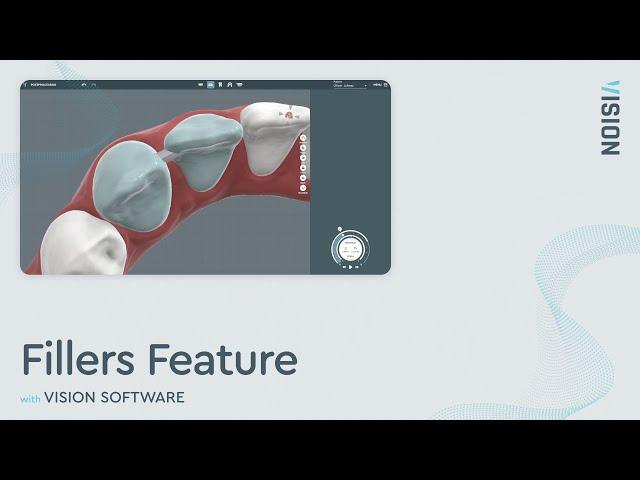 Fillers Feature for Digital Dental Filling Tool Procedure