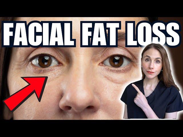 Demystifying Facial Fat Loss: Everything You Need To Know!