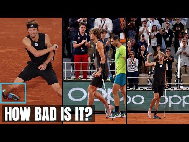 Expert Explains Alex Sverev Ankle Injury & Return Timeline Scenarios