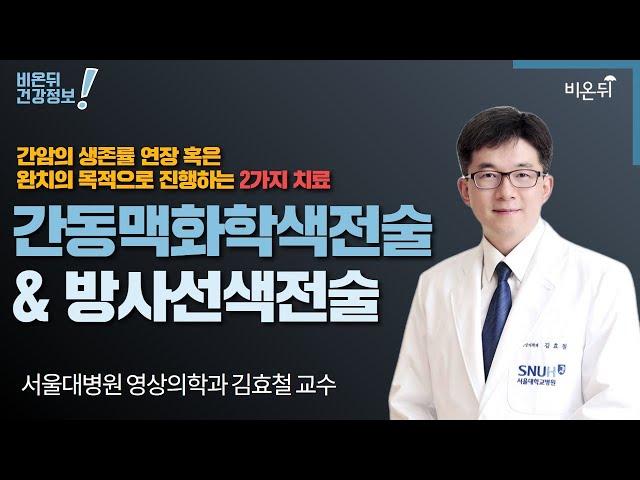 간암의 생존률 연장 혹은 완치의 목적으로 진행하는 2가지 치료: 간동맥화학색전술 & 방사선색전술 (서울대병원 영상의학과 김효철 교수)