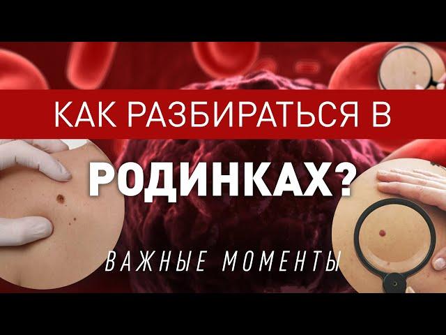 Родинки или Меланома, как разобраться самостоятельно?