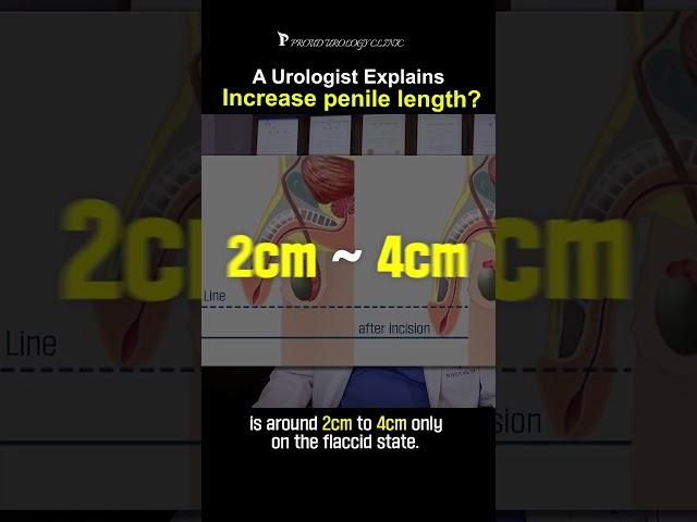 Penis Lengthening Surgery