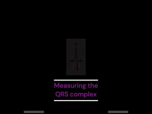 How to measure the QRS complex
