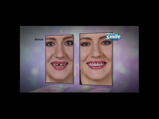 Perfect Smile Veneers Commercial - As Seen on TV