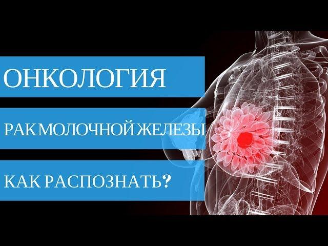 Как распознать РАК МОЛОЧНОЙ ЖЕЛЕЗЫ на ранних стадиях? Ответ в нашем видео!