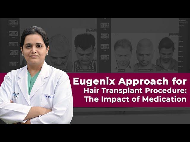 Hair Transplant Procedure: Eugenix Approach for Before & After Effects of Medication