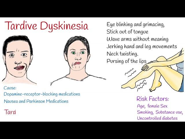 Tardive dyskinesia Causes, Symptoms and Treatment