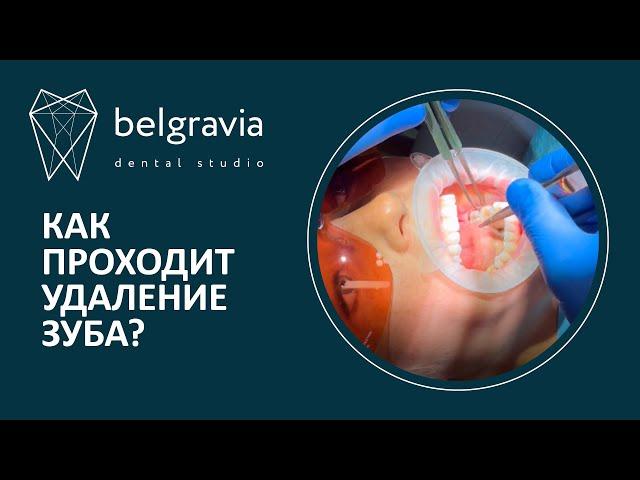 Как проходит удаление зуба в стоматологии Belgravia Dental Studio