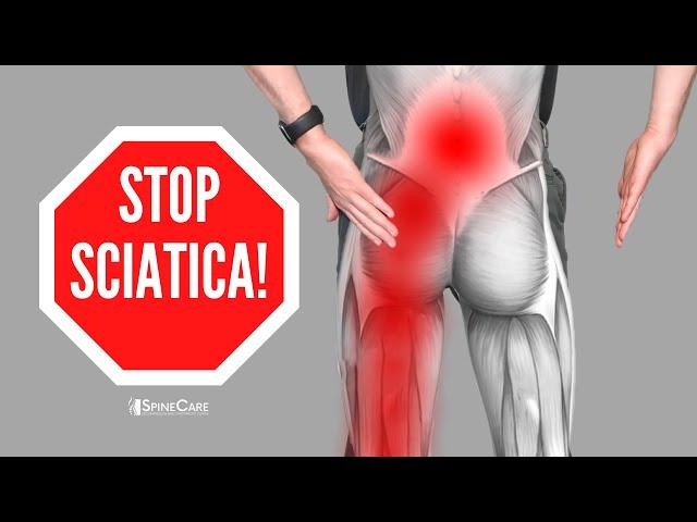 How to Relieve Sciatica Pain in SECONDS