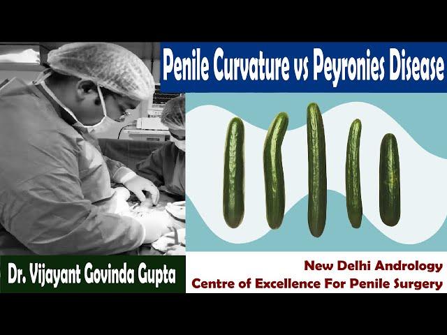 Curved Penis Causes - Penile Curvature vs Peyronies Disease