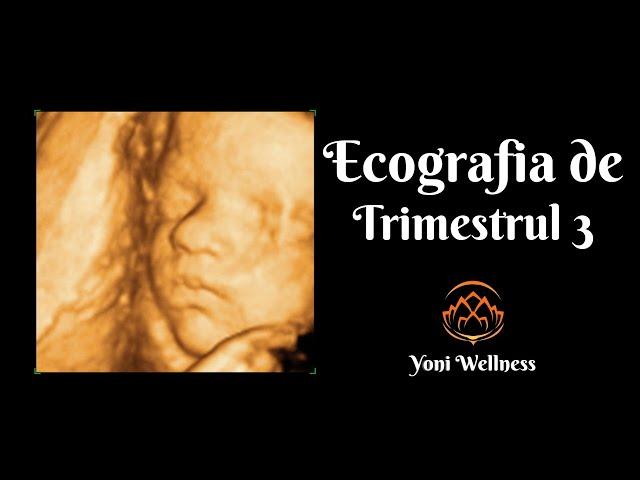 S1.Ep45: Ecografia în trimestrul 3 de sarcină | Răspunsul definitiv la întrebarea:Pot naşte natural?