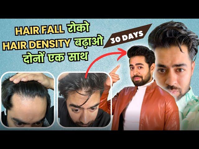 100% HAIRFALL रुकेगा और HAIR DENSITY DOUBLE हो जाएगी | ULTIMATE MEN'S HAIR CARE ROUTINE