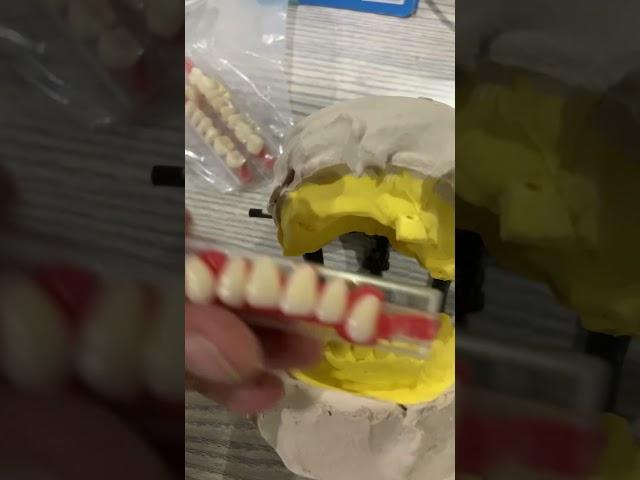 Partial denture setup #umairtoothfairy #dentist #umairazeem #shorts @Umairazeem8553