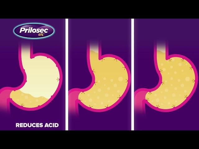 Why Prilosec OTC?