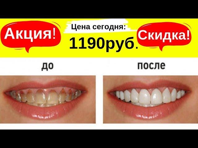 Виниры для зубов. Скидка -50% | Ссылка в описании.