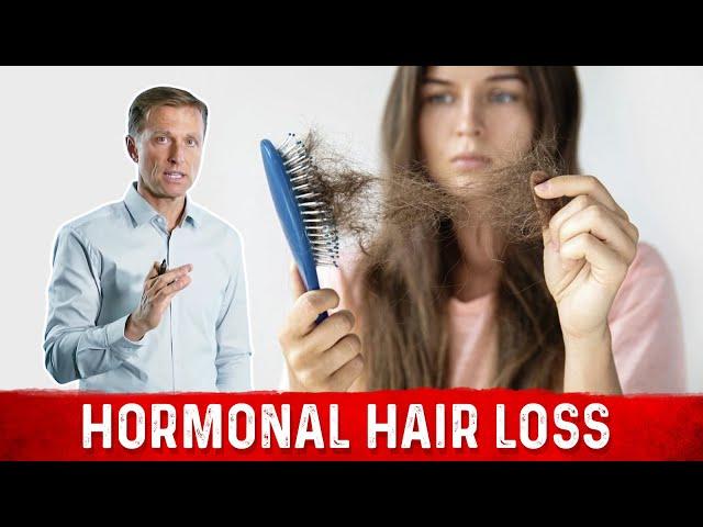 6 Root Causes of Hair Loss – Dr. Berg on Hormonal Hair Loss