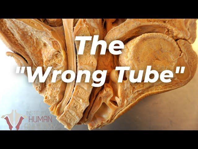 How BAD Is It When Something Goes Down the "Wrong Tube"???