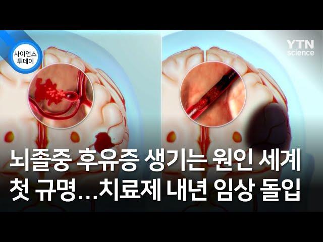 뇌졸중 후유증 생기는 원인 세계 첫 규명...치료제 내년 임상 돌입 / YTN 사이언스