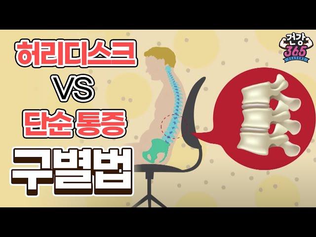 허리디스크 vs 단순 통증 구별법 / YTN 라이프