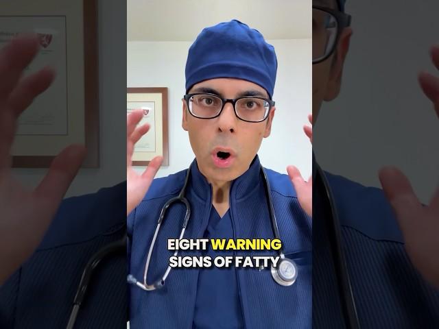 Harvard Liver Specialist: 8 Warning Signs of Fatty Liver You Do Not Want to Miss 